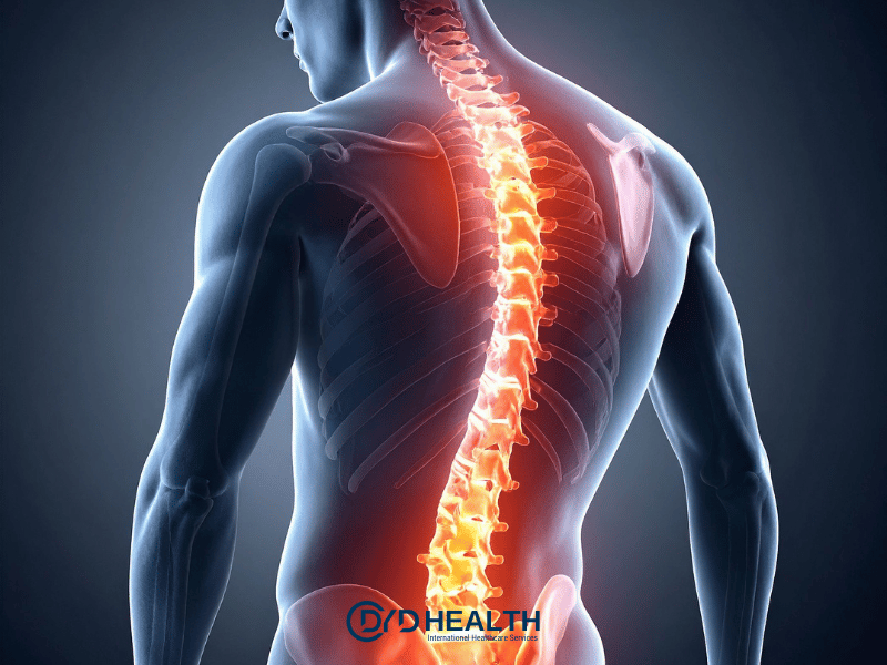 Skolyoz Ameliyatları