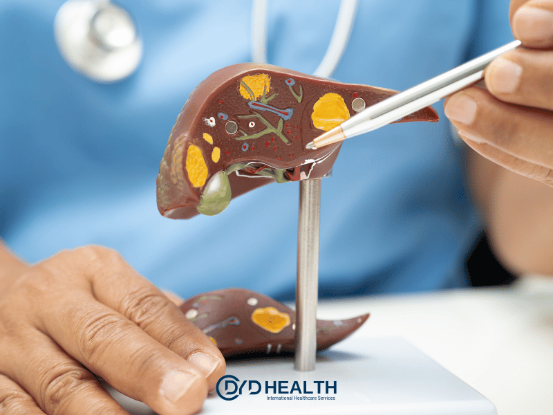 Karaciğer Nakli S&uuml;reci