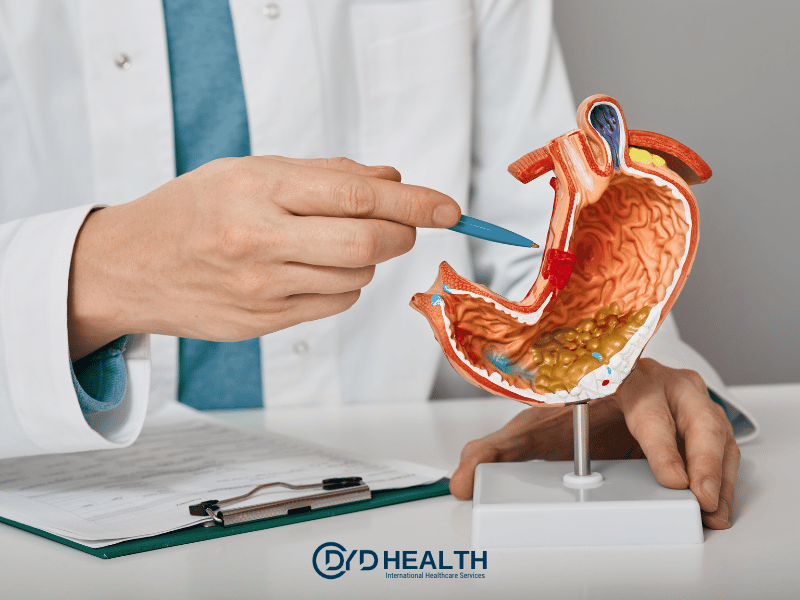 T&uuml;p Mide Ameliyatı