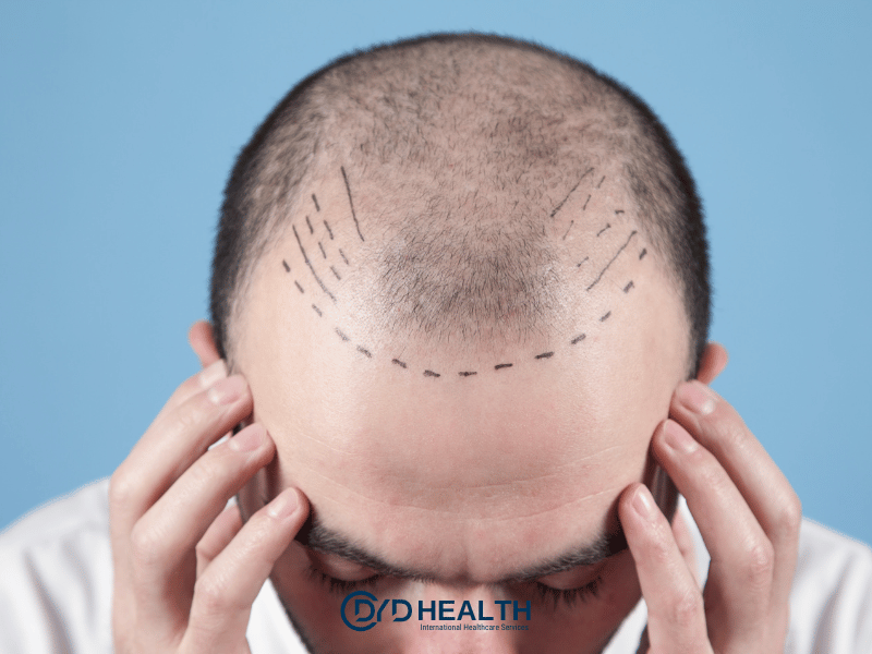 DHI Sa&ccedil; Ekimi