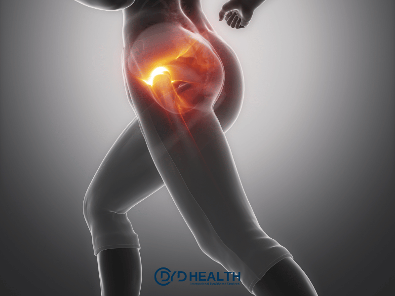 Brezilya Popo Kaldırma