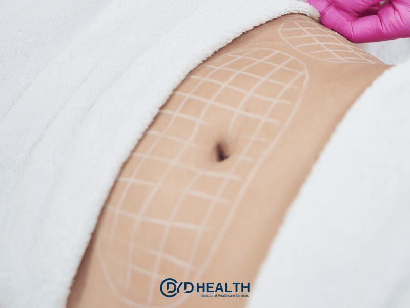 V&uuml;cut Estetiği Hizmetleri