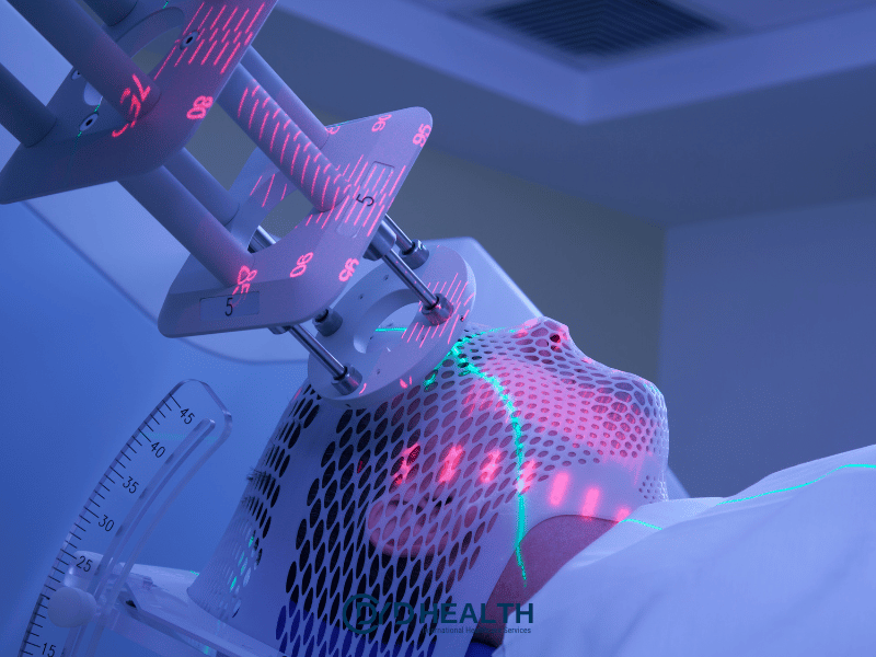 Radyoterapinin Yan Etkileri